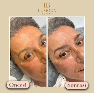 Lumora Beauty — kare 4