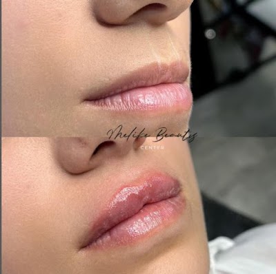 Melike Beauty Center — kare 4