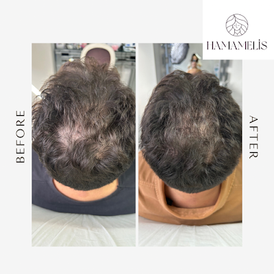 HAMAMELİS ® | CİLTTE SANAT — kare 4