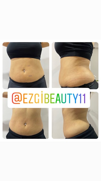 Ezgi Beauty — kare 4
